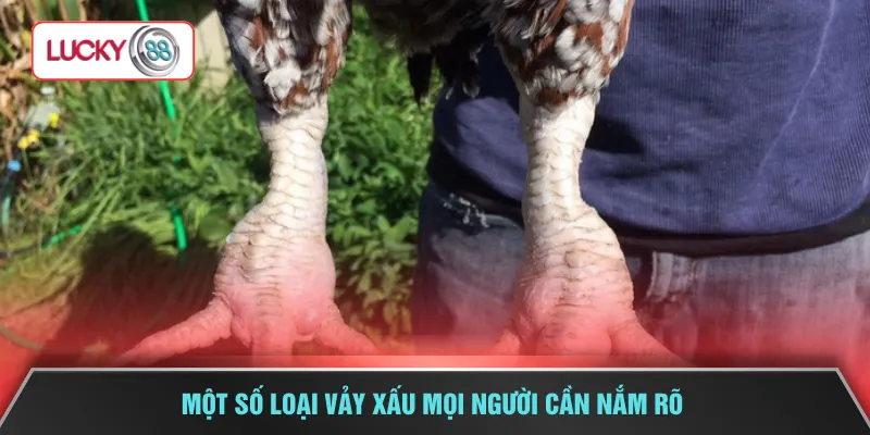 Một số loại vảy xấu mọi người cần nắm rõ